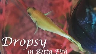 Dropsy in Betta Fish  Symptoms Prevention Life Expectancy amp More [upl. by Zink]