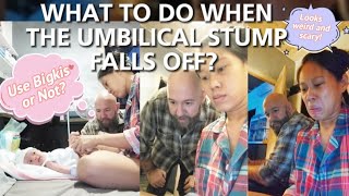 Newborn Umbilical Stump Falls Off What To Do First Time Parents Reaction [upl. by Janus]