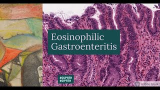 Eosinophilic Gastroenteritis [upl. by Ailb677]