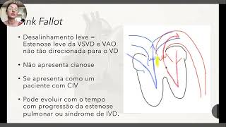 Tetralogia de Fallot  explicação completa [upl. by Eocsor215]