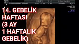 14 gebelik haftası içinde 3 ay 1 haftada anne karnında bebeğe ait ultrason görüntüleri erkek [upl. by Yve]