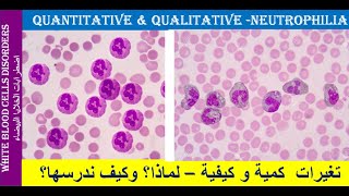 lecture 22 Neutrophilia Quantitative and Qualitative Changes [upl. by Grindle148]