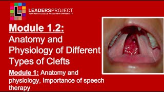 Module 12 Cleft Palate Speech and Feeding Anatomy and Physiology of Cleft Lip and Palate [upl. by Aidahs]