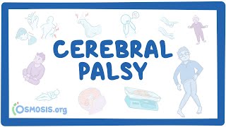 Cerebral palsy CP  causes symptoms diagnosis treatment pathology [upl. by Aihcrop]