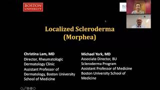 Localized Scleroderma Morphea Christina Lam MD Michael York MD [upl. by Jacoby]