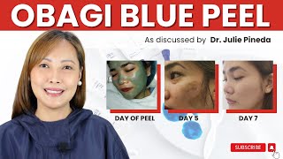 OBAGI BLUE PEEL TREATMENT [upl. by Ysiad]