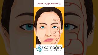 Understanding Hemifacial Spasm HemifacialSpasm DrKNeeraja Neurologist SamagraHospitals Guntur [upl. by Cleodell]