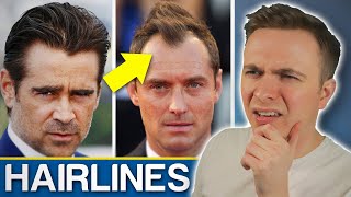 Widows Peak VS Receding Hairline  Should You Be Worried [upl. by Ashelman303]