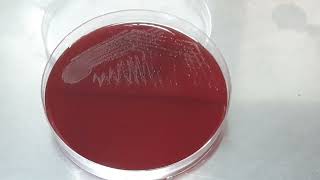 Colony characteristics of Streptococcus agalactiae on blood agar of Urine Culture [upl. by Adivad]