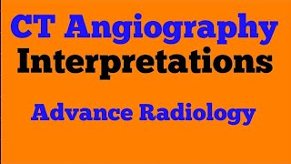 How to Do CT Angiography [upl. by Lirrad196]