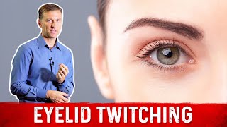 Eyelid Twitching Find Out Causes and Cure – Dr Berg [upl. by Airotahs181]