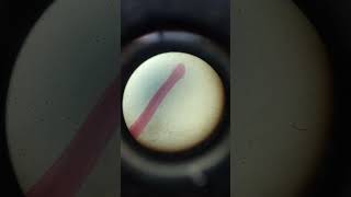 Ancylostoma whole mount zoology practical lab 🧪shorts [upl. by Oibesue]