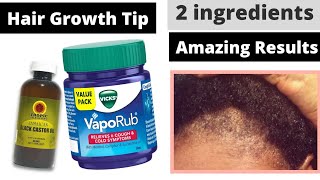 How to use Vicks vaporub for Faster Hair Growth [upl. by Yaj]