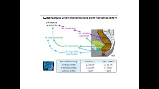 Lymphabfluss und Höheneinteilung beim Rektumkarzinom  Strahlentherapie Prof Hilke Vorwerk [upl. by Seabrook]