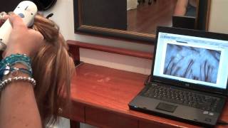 Hair Health Check amp Scalp Check with Brisbane Trichologist [upl. by Ratep]