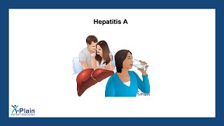 Hepatitis A [upl. by Nalaf]