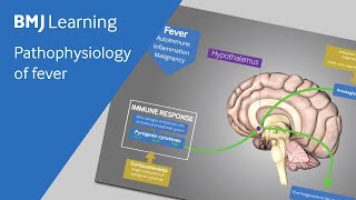 Pathophysiology of fever explained [upl. by Sylas]