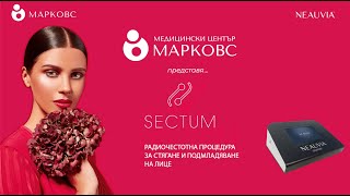 Радиочестотна терапия на лице в МЦ МАРКОВС с мултифункционален апарат Septum от Neauvia [upl. by Eceirtal336]