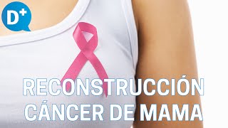 Reconstrucción mamaria para pacientes de cáncer de mama [upl. by Eylrac342]