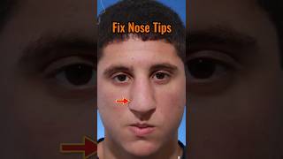 Fix nose tip and get SLIM NOSE viral attractive handsome [upl. by Anyaled]