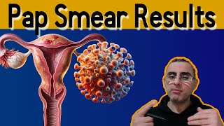 Pap Smear 101  Explained Pap Smear results meaning Pap Test [upl. by Nine]