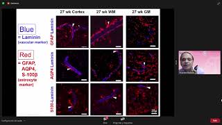 2 Germinal Matrix why the haemorrhage [upl. by Tera]