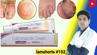 Luliconazole cream के फायदे  Luliconazole cream 1 ww uses in hindi Shorts lamshorts [upl. by Fisuoy289]