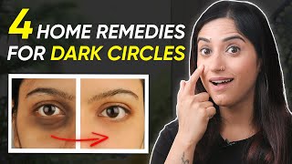 Erase DARK CIRCLES like Magic  4 Home Remedies for Glowing Skin  By GunjanShouts [upl. by Lewiss117]