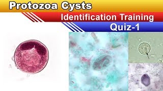 Protozoa Cysts Identification Training Quiz  Part 1 [upl. by Llekram402]