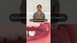 Ask the Dentist Does everyone have wisdom teeth 🤔🦷 wisdomteeth askthedentist [upl. by Ahsatniuq]