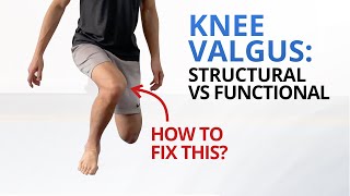 Why You Need to Fix Dynamic Knee Valgus NOW [upl. by Ecnedurp479]