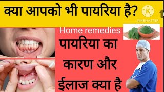 पायरिया के कारण और ईलाज periodontitis cause and its treatmentpyorrhea home remedies [upl. by Sayers450]