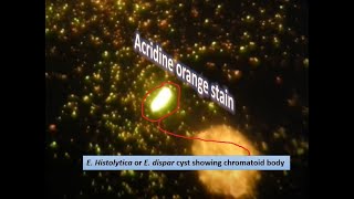 Acidine orange stained slide of chromatoid body of E histolytica or dispar [upl. by Dow]