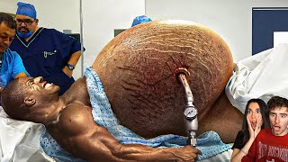 This Bodybuilder Took It WAY TOO FAR [upl. by Pravit400]