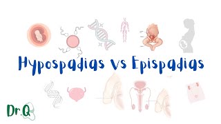 Hypospadias vs Epispadias  embryology MyClinicalBook [upl. by Remmer]