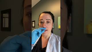 Frenectomy Lip post op exercises [upl. by Jaclyn959]