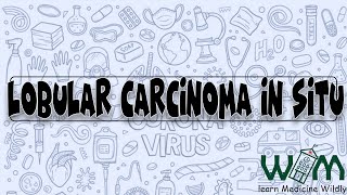 Lobular Carcinoma in Situ  Everything you need for board exam [upl. by Tiga]