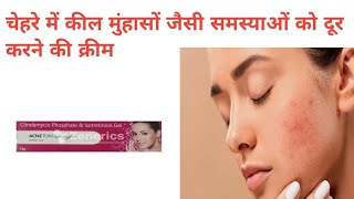 Acne Toin Plus Gel Use In Hindi acnetreatment pharmacist knowledge [upl. by Judy25]