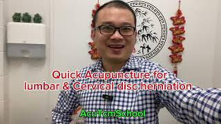 Quick Acupuncture for lumbar amp Cervical disc herniation [upl. by Sell]