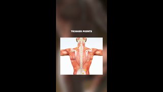 Most pain doesn’t start in joints—it begins in muscle “trigger points” [upl. by Ariela]