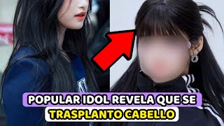 POPULAR IDOL REVELA ABIERTAMENTE QUE SE TRASPLANTO CABELLO [upl. by Kala226]