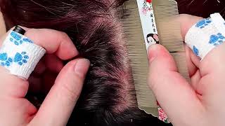 Quiet ASMR Scalp Care Gentle Exfoliation amp Dandruff Removal No Speaking [upl. by Yssim259]