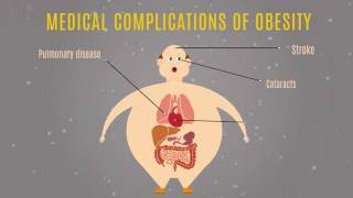 What Is Obesity [upl. by Anima]