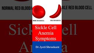 Sickle cell anemia symptoms shorts ytshorts [upl. by Ramhaj658]