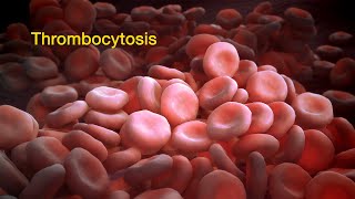 High Platelet Count Causes What is Thrombocytosis [upl. by Alidia766]