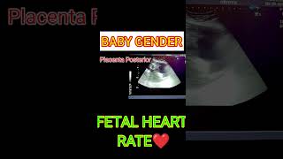 FETAL HEART RATE VS BABY GENDER shortsfeed shorts [upl. by Ohaus]