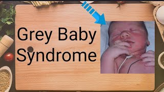 Gray Baby Syndrome chloramphenicol [upl. by Frederik]