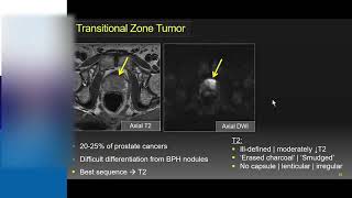 Prostate Anatomy [upl. by Georgeanna]