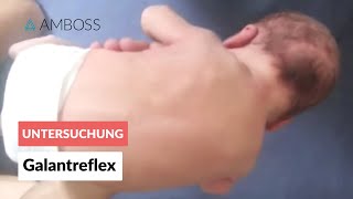 Galantreflex  Frühkindliche Reflexe  AMBOSS Video [upl. by Chrysa49]