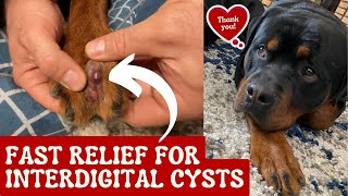 Fast Relief For Interdigital Cysts [upl. by Alenairam970]